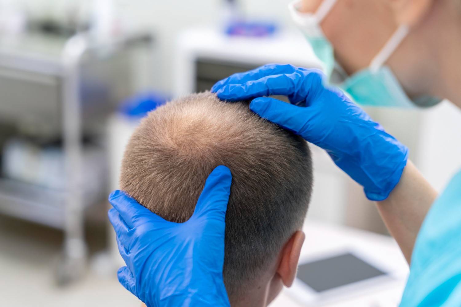 scalp micropigmentation vs hair transplant