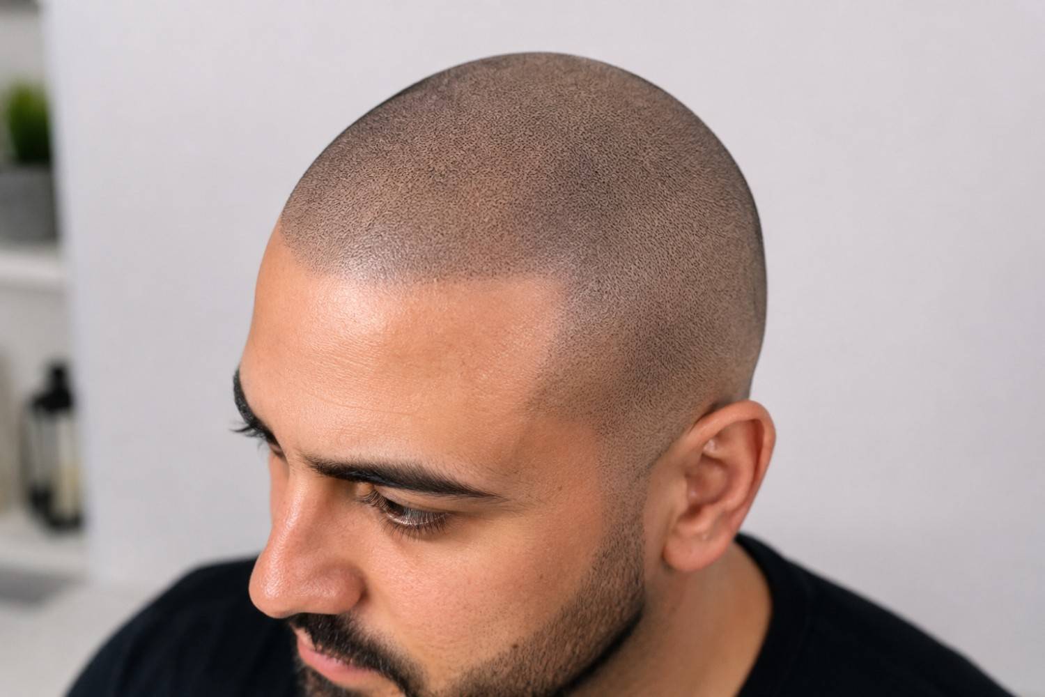 learn how realistic scalp micropigmentation looks